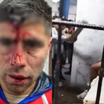 Brutal ataque en Berazategui: le clavaron una llave en la cabeza a un jugador del ascenso